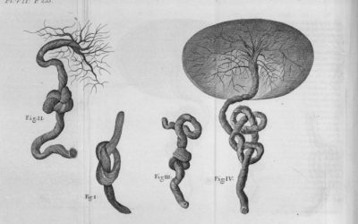 Infanticidi i medicina legal